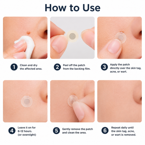 Alcuras® 2-in-1 Microneedle & Hydrocolloid Patch