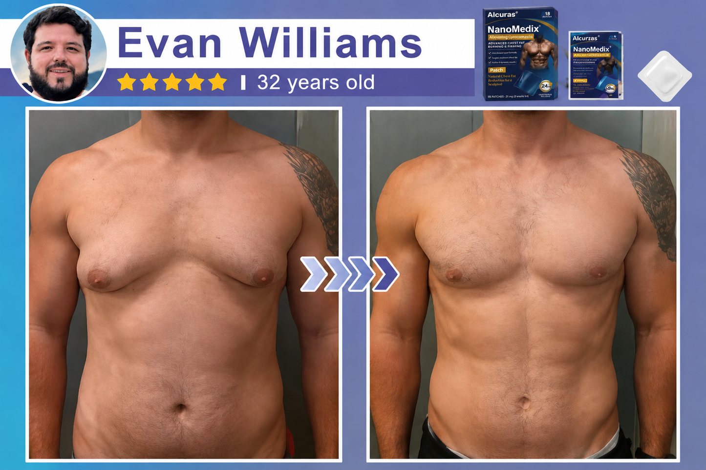 Alcuras® SculptXX Gynecomastia Burn & Firm Chest Patch
