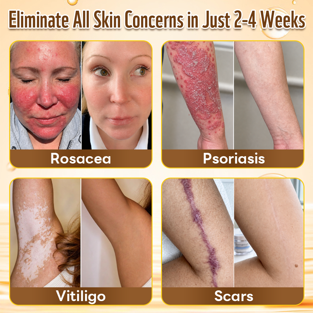 Last Day 80% OFF🐝Alcuras® Multi-Concern Skin Repair Cream