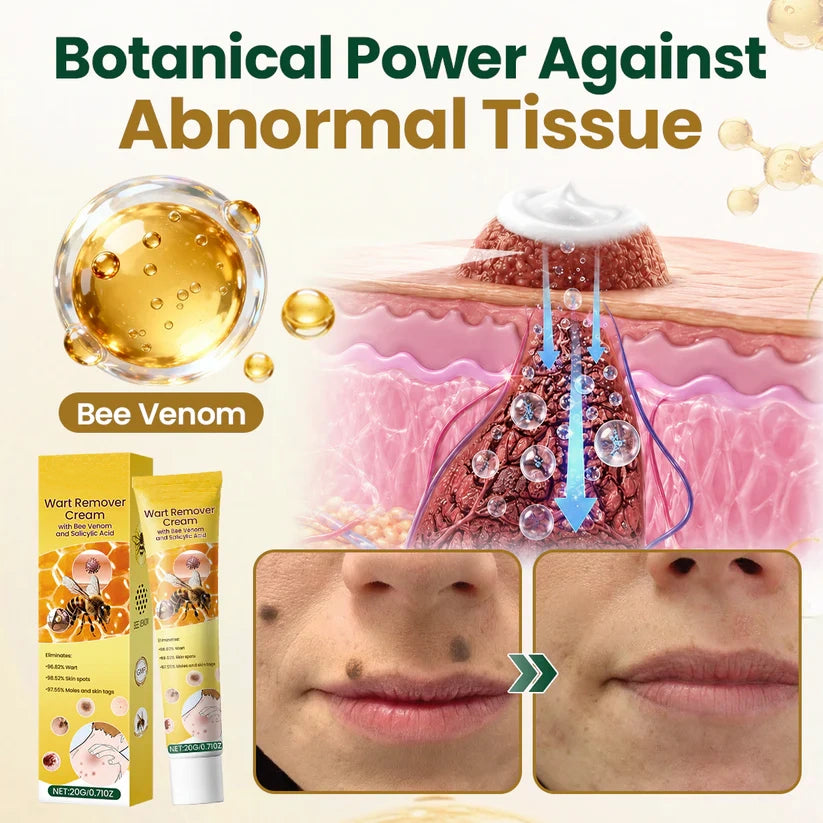 Alcuras® Wart Remover Cream with Bee Venom and Salicylic Acid – Skin Tag Removal & Skin Repair Formula for Face and Body