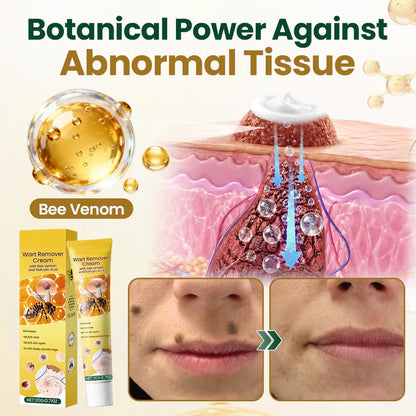 Alcuras® Wart Remover Cream with Bee Venom and Salicylic Acid – Skin Tag Removal & Skin Repair Formula for Face and Body