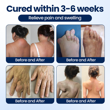 Alcuras® ArthriNAD+ Pro Advanced Joint Recovery Cream