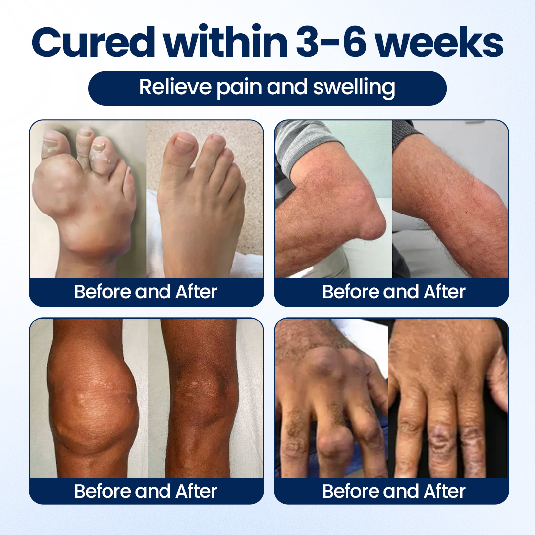 Alcuras® ArthriNAD+ Pro Advanced Joint Recovery Cream