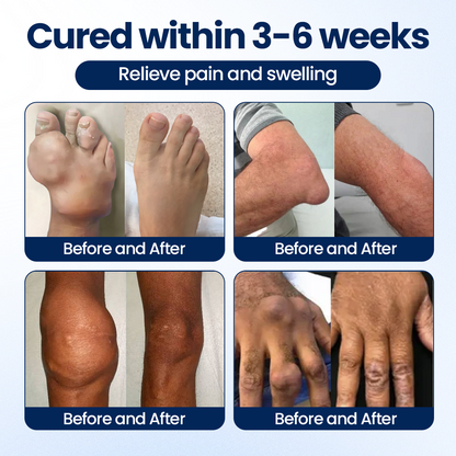 Alcuras® ArthriNAD+ Pro Advanced Joint Recovery Cream