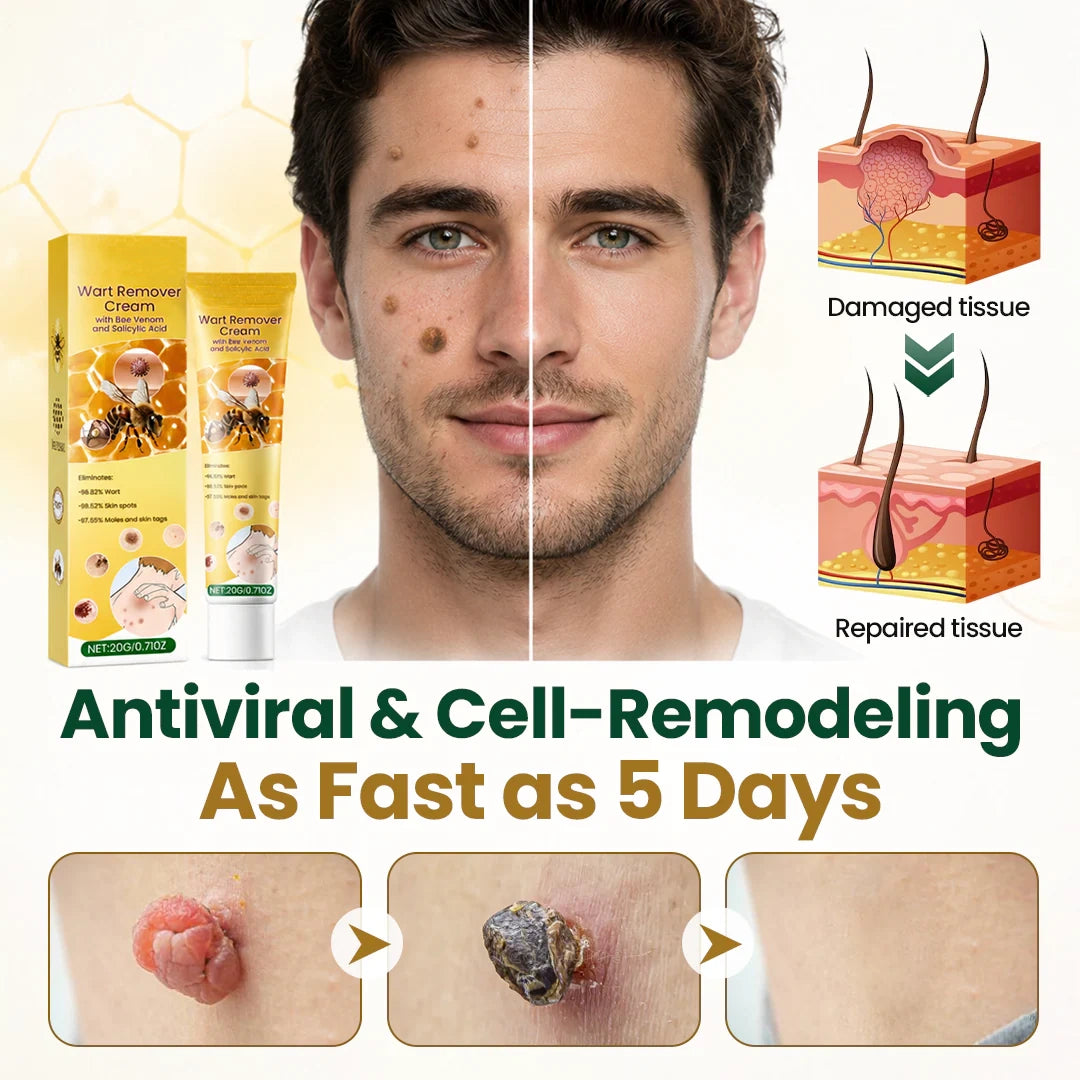 Alcuras® Wart Remover Cream with Bee Venom and Salicylic Acid – Skin Tag Removal & Skin Repair Formula for Face and Body