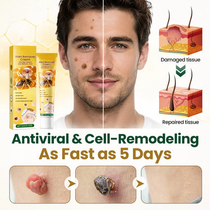Alcuras® Wart Remover Cream with Bee Venom and Salicylic Acid – Skin Tag Removal & Skin Repair Formula for Face and Body
