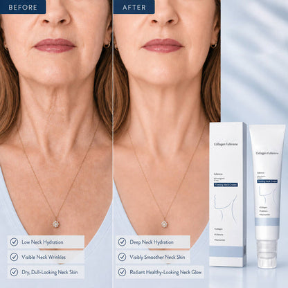 🔥Last Day 50% OFF🔥Alcuras® Roller Massage Neck Cream