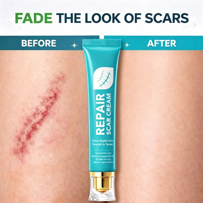 Last Day 49% OFF🎁Alcuras® Scar Repair Cream
