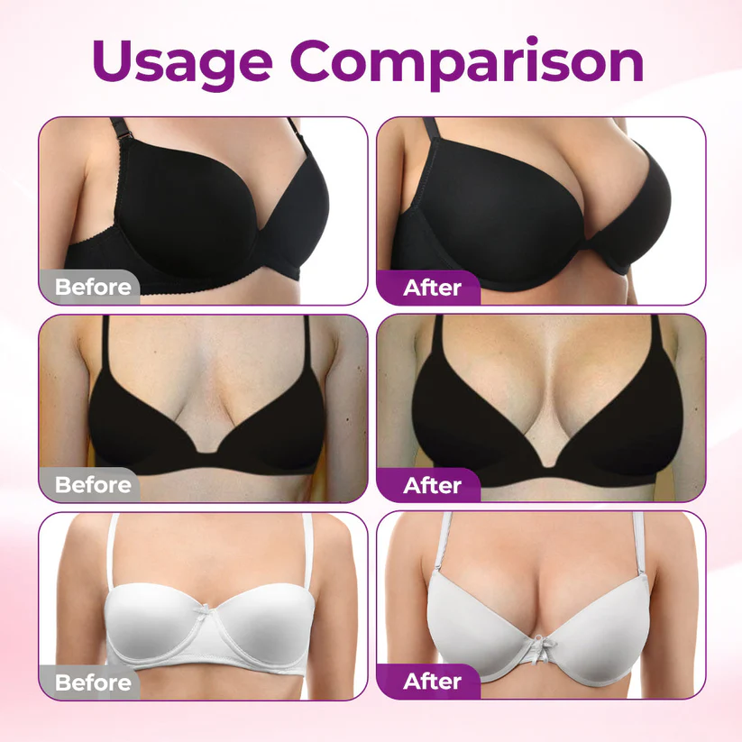 Last Day 49% OFF🔥Alcuras® Targeted Breast Enhancement Advanced Nano Microneedle Patch
