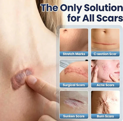 Last Day 49% OFF🎁Alcuras® Scar Repair Cream