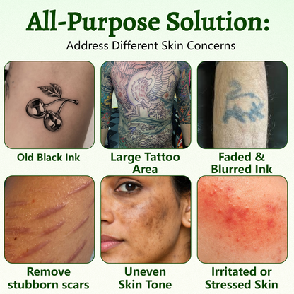 Alcuras® PureAlgae Ink Removal Support Spray 🌿 — Say Goodbye to Old Tattoo Pigment 💚, Fade Stubborn Ink ✨, Repair & Smooth Treated Skin 💧, Non-Laser ✅, Try It Now! 🔥