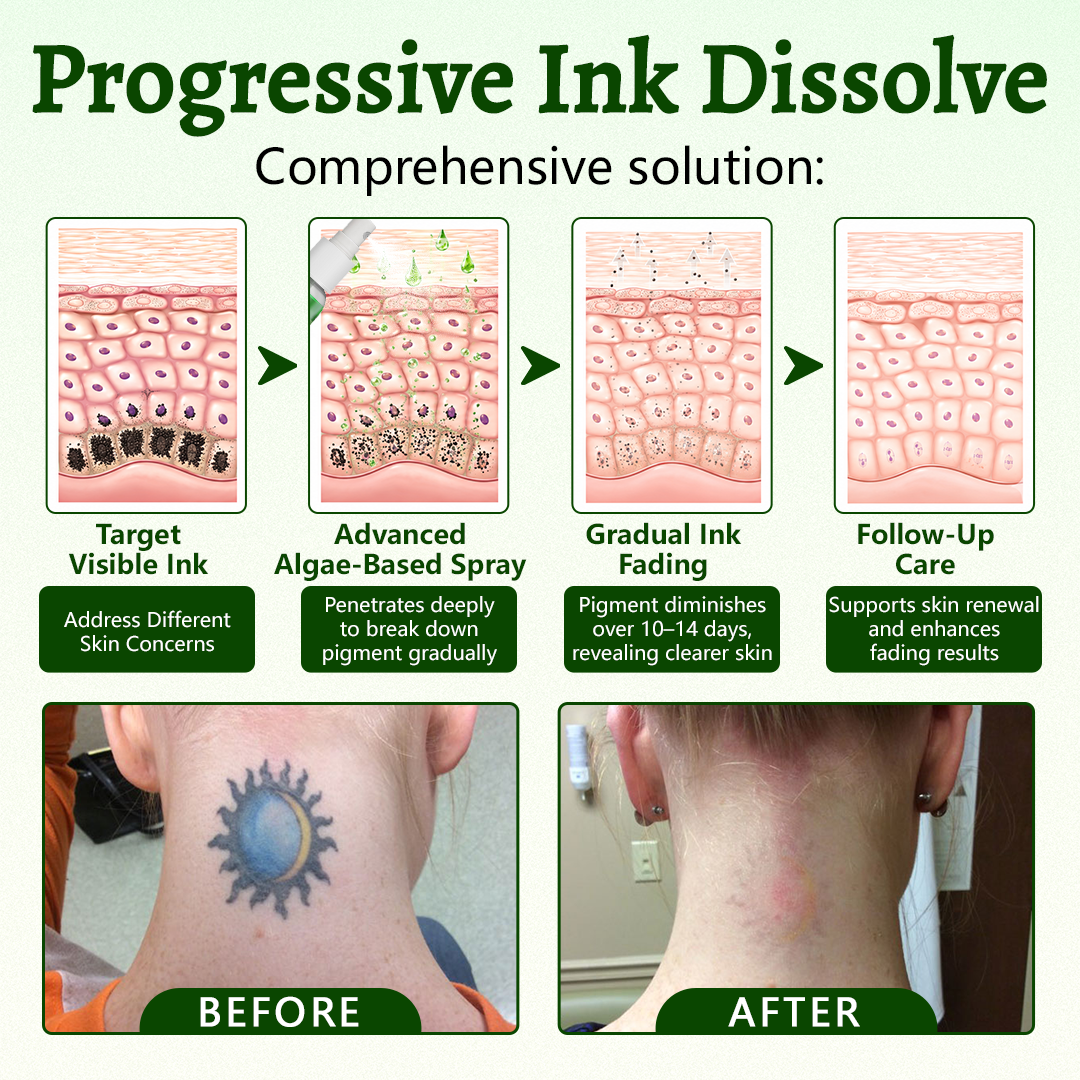 Alcuras® PureAlgae Ink Removal Support Spray 🌿 — Say Goodbye to Old Tattoo Pigment 💚, Fade Stubborn Ink ✨, Repair & Smooth Treated Skin 💧, Non-Laser ✅, Try It Now! 🔥