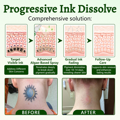 Alcuras® PureAlgae Ink Removal Support Spray 🌿 — Say Goodbye to Old Tattoo Pigment 💚, Fade Stubborn Ink ✨, Repair & Smooth Treated Skin 💧, Non-Laser ✅, Try It Now! 🔥