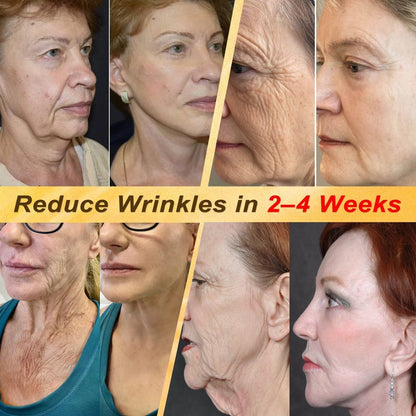 Last Day 80% OFF🐝Alcuras® Multi-Concern Skin Repair Cream