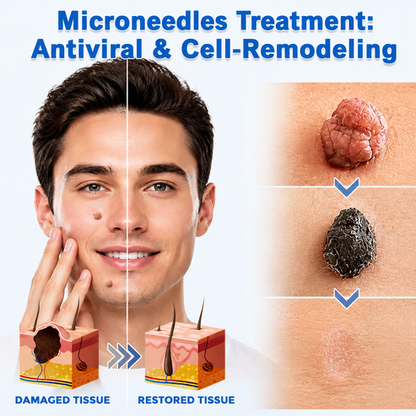 Alcuras® 2-in-1 Microneedle & Hydrocolloid Patch