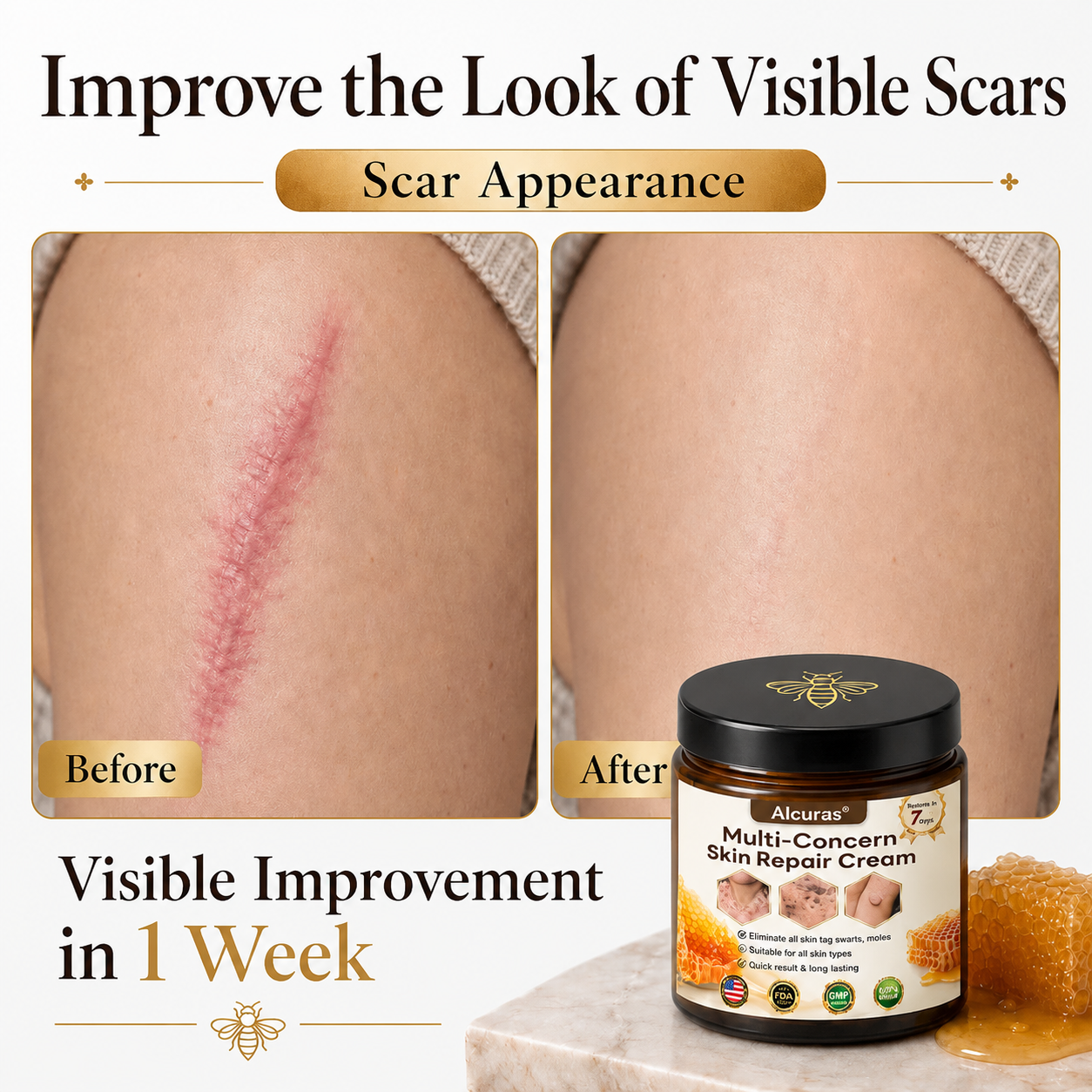 Last Day 80% OFF🐝Alcuras® Multi-Concern Skin Repair Cream