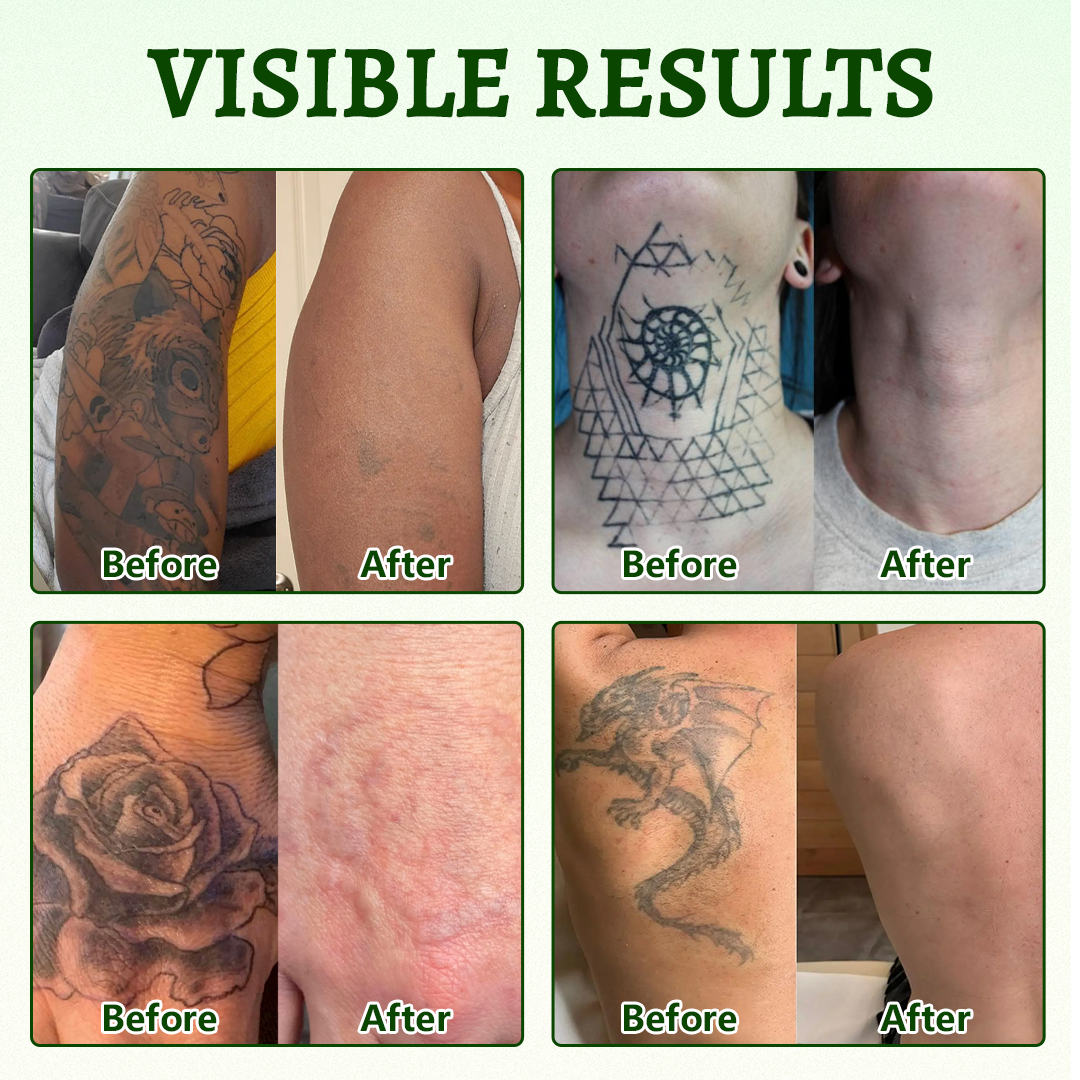 Alcuras® PureAlgae Ink Removal Support Spray 🌿 — Say Goodbye to Old Tattoo Pigment 💚, Fade Stubborn Ink ✨, Repair & Smooth Treated Skin 💧, Non-Laser ✅, Try It Now! 🔥