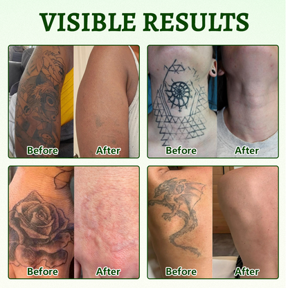 Alcuras® PureAlgae Ink Removal Support Spray 🌿 — Say Goodbye to Old Tattoo Pigment 💚, Fade Stubborn Ink ✨, Repair & Smooth Treated Skin 💧, Non-Laser ✅, Try It Now! 🔥