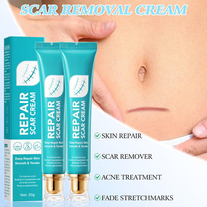 Last Day 49% OFF🎁Alcuras® Scar Repair Cream