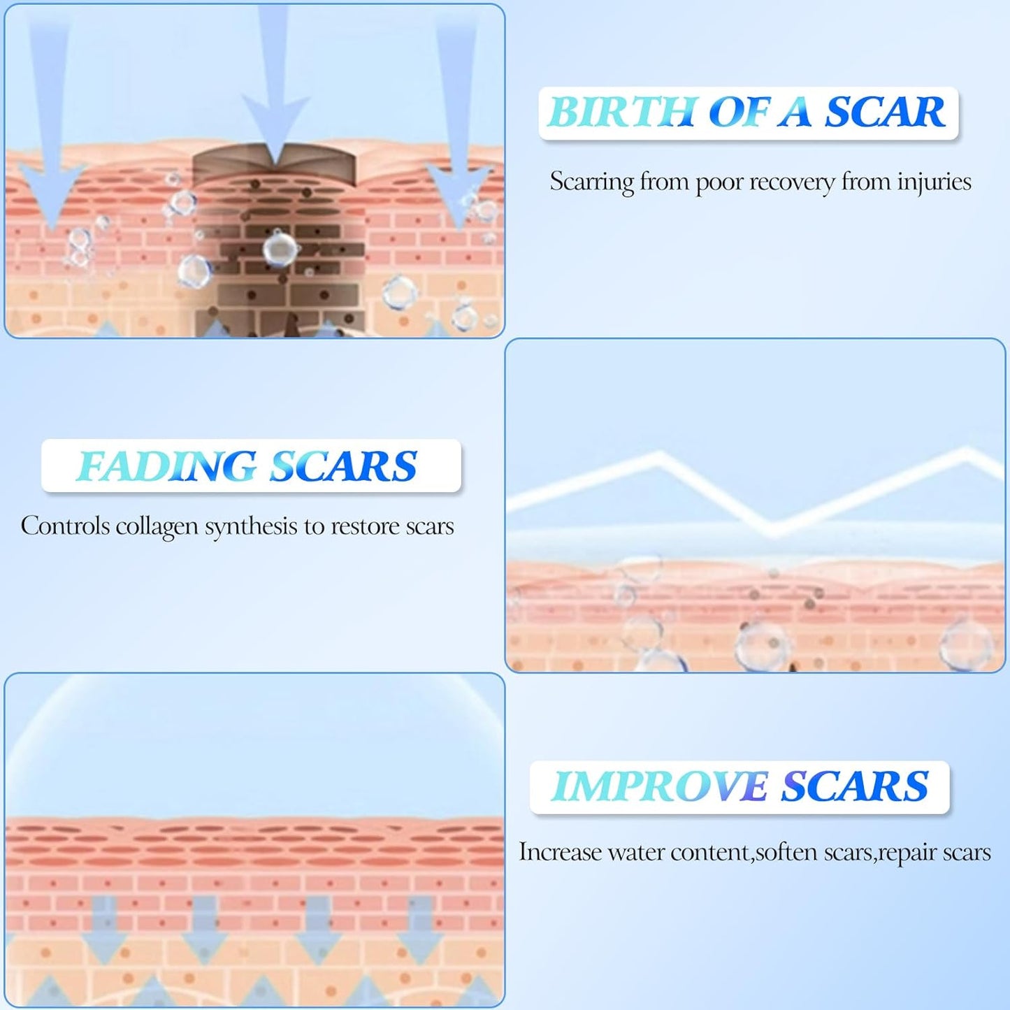 Last Day 49% OFF🎁Alcuras® Scar Repair Cream