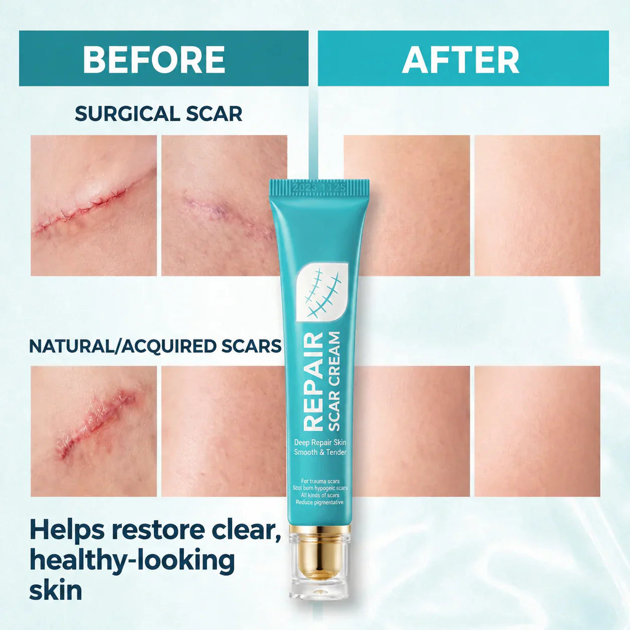Last Day 49% OFF🎁Alcuras® Scar Repair Cream