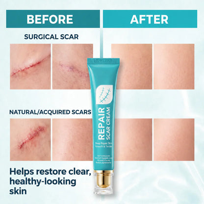 Last Day 49% OFF🎁Alcuras® Scar Repair Cream