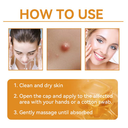 Last Day 80% OFF🐝Alcuras® Multi-Concern Skin Repair Cream