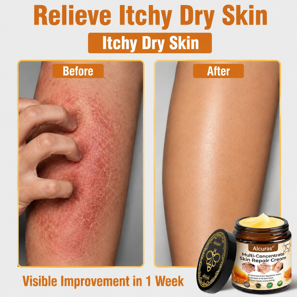 Last Day 80% OFF🐝Alcuras® Multi-Concern Skin Repair Cream