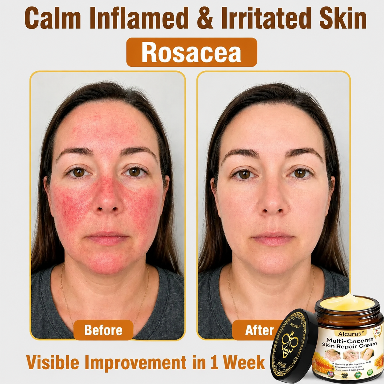 Last Day 80% OFF🐝Alcuras® Multi-Concern Skin Repair Cream