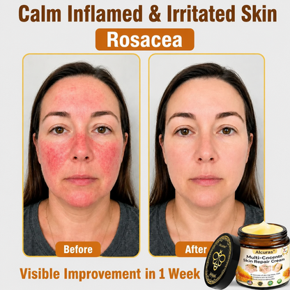 Last Day 80% OFF🐝Alcuras® Multi-Concern Skin Repair Cream